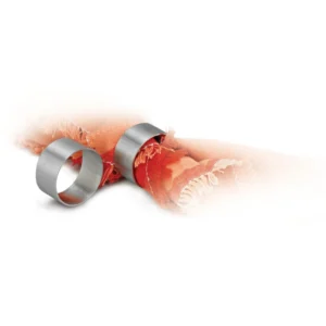 Napkin Ring